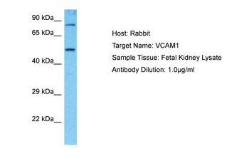 VCAM1 Rabbit Polyclonal Antibody