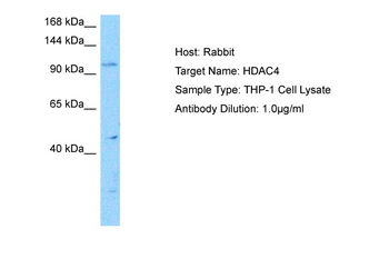 HDAC4 Rabbit Polyclonal Antibody