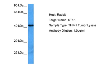 ST13 Rabbit Polyclonal Antibody