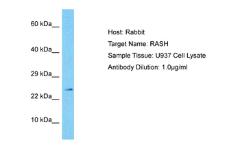 HRAS Rabbit Polyclonal Antibody
