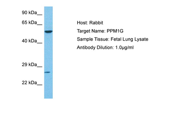 PPM1G Rabbit Polyclonal Antibody