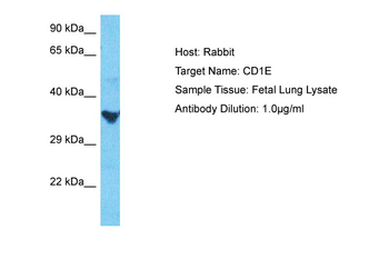 CD1E Rabbit Polyclonal Antibody