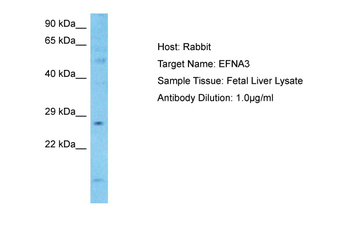 EFNA3 Rabbit Polyclonal Antibody