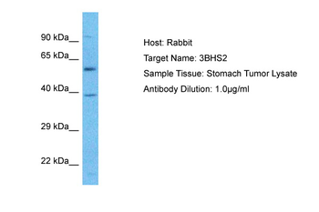 HSD3B2 Rabbit Polyclonal Antibody