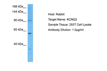 KCNQ2 Rabbit Polyclonal Antibody