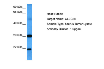 CLEC3B Rabbit Polyclonal Antibody