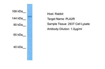 PLA2R1 Rabbit Polyclonal Antibody
