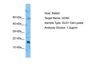 UCN3 Rabbit Polyclonal Antibody