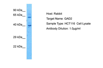 GAD2 Rabbit Polyclonal Antibody