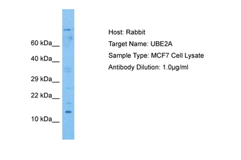 UBE2A Rabbit Polyclonal Antibody