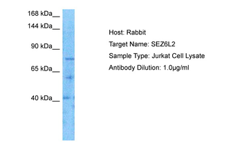 SEZ6L2 Rabbit Polyclonal Antibody