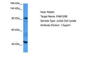 FAM120B Rabbit Polyclonal Antibody