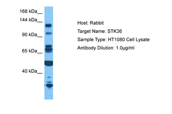 STK36 Rabbit Polyclonal Antibody