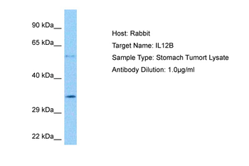 IL12B Rabbit Polyclonal Antibody