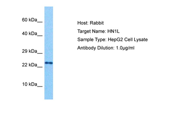 JPT2 Rabbit Polyclonal Antibody