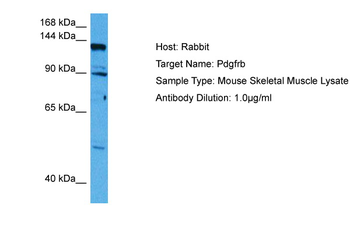PDGFRB Rabbit Polyclonal Antibody