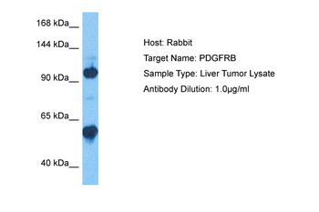 PDGFRB Rabbit Polyclonal Antibody