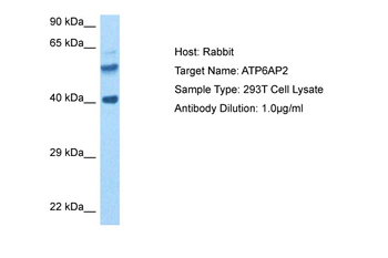 ATP6AP2 Rabbit Polyclonal Antibody