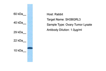 SH3BGRL3 Rabbit Polyclonal Antibody