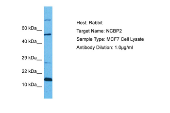 NCBP2 Rabbit Polyclonal Antibody