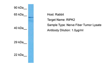 RIPK2 Rabbit Polyclonal Antibody