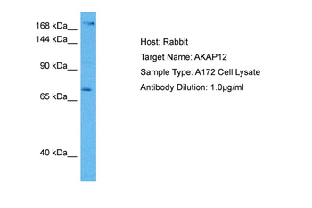 AKAP12 Rabbit Polyclonal Antibody