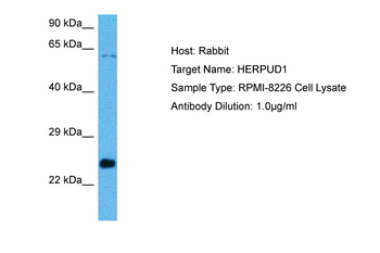 HERPUD1 Rabbit Polyclonal Antibody