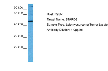 STARD3 Rabbit Polyclonal Antibody