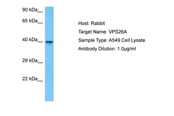 VPS26A Rabbit Polyclonal Antibody