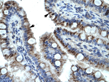 KRT15 Rabbit Polyclonal Antibody