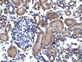 BCL2 Rabbit Polyclonal Antibody