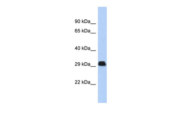 BCL2L1 Rabbit Polyclonal Antibody