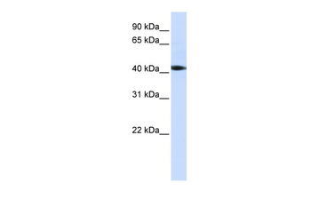 STK17A Rabbit Polyclonal Antibody