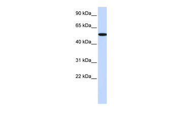 RIPK2 Rabbit Polyclonal Antibody