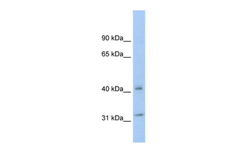 YWHAQ Rabbit Polyclonal Antibody