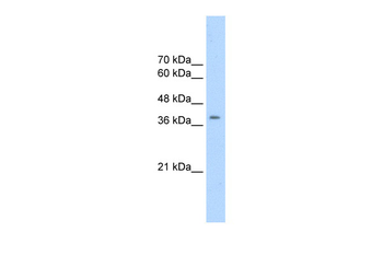 CDK9 Rabbit Polyclonal Antibody