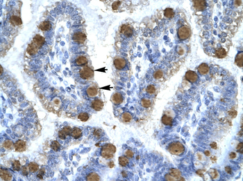 CDK7 Rabbit Polyclonal Antibody