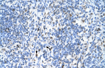 PCNA Rabbit Polyclonal Antibody