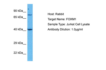 FOXM1 Rabbit Polyclonal Antibody