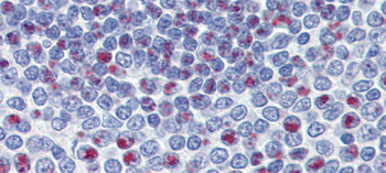 FOXM1 Rabbit Polyclonal Antibody