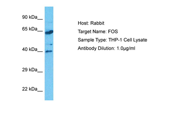 FOS Rabbit Polyclonal Antibody