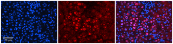 FOS Rabbit Polyclonal Antibody