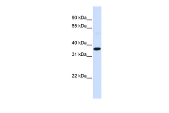 FOS Rabbit Polyclonal Antibody