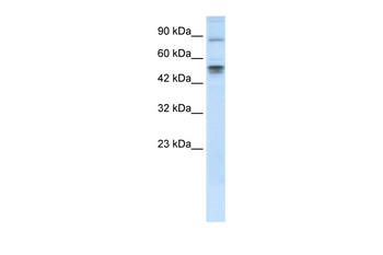 MDM4 Rabbit Polyclonal Antibody