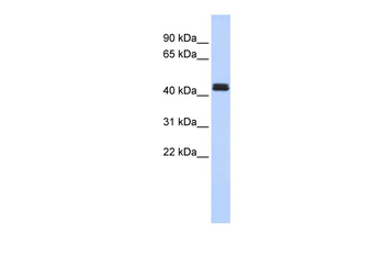 TRAF1 Rabbit Polyclonal Antibody