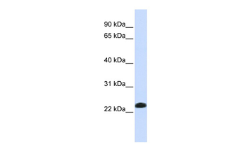 CAV2 Rabbit Polyclonal Antibody