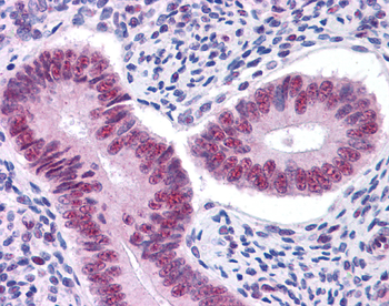 STAT3 Rabbit Polyclonal Antibody