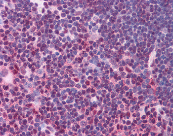 STAT3 Rabbit Polyclonal Antibody