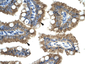 CHRNA1 Rabbit Polyclonal Antibody