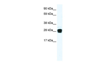 TNFSF12 Rabbit Polyclonal Antibody